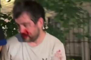 世界杯瑞士vs波黑直播入口_世界杯瑞士vs波黑直播入口在线观看_免费看直播